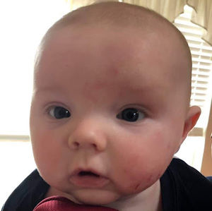 Meet your Posher, Helmut